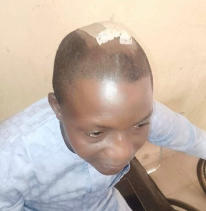 NUJ, IPC Condemn Police Assault On Journalist In Bauchi